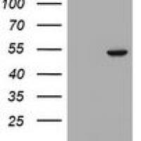 Selenium Binding Protein 1 (SELENBP1) Mouse Monoclonal Antibody [Clone ID: OTI3A3]