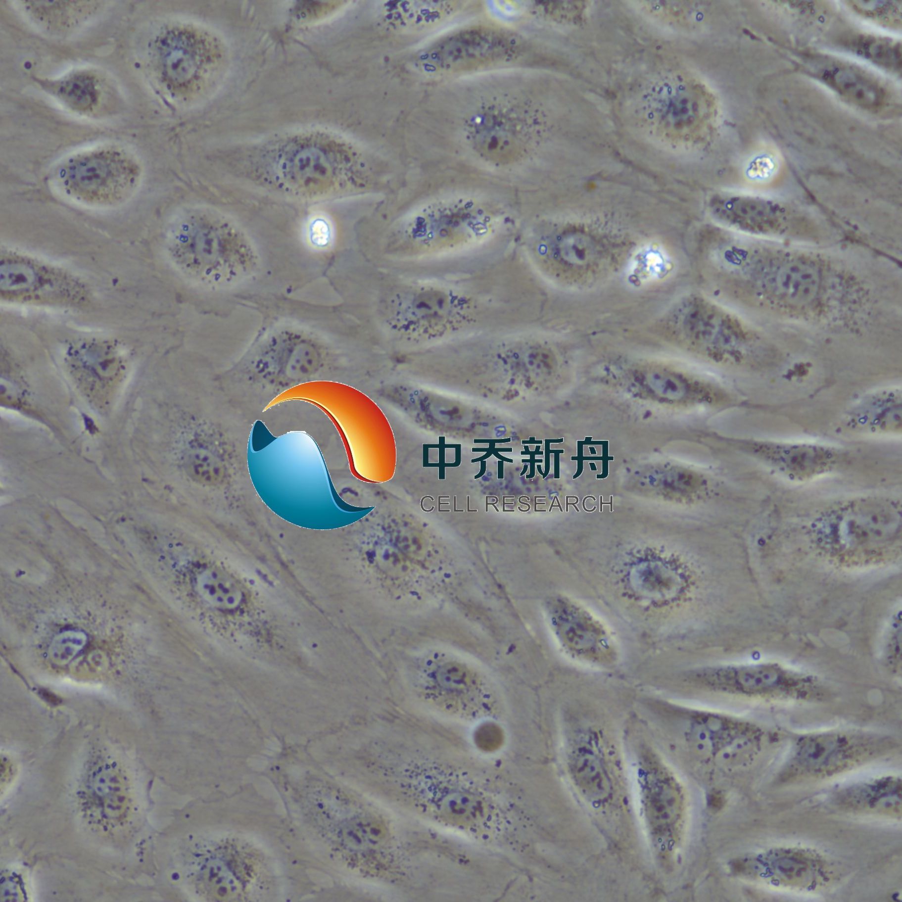 人肺动脉内皮细胞永生化