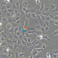 HTR-8/Svneo人绒毛膜滋养层细胞