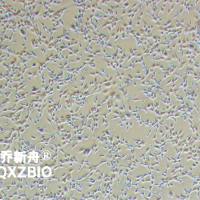 STO小鼠胚胎成纤维细胞（种属鉴定）