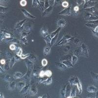 MDA-MB-231 人乳腺癌细胞/MDA-MB-231/MDA-MB-231细胞/STR鉴定/镜像绮点（Cellverse）