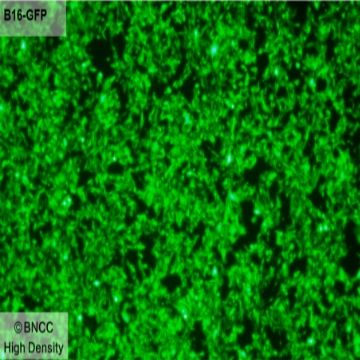小鼠黑色素瘤细胞（绿色荧光蛋白标记）