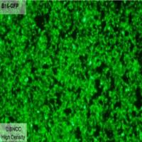 小鼠黑色素瘤细胞（绿色荧光蛋白标记）