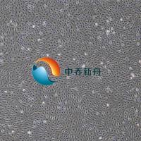 人表皮角质形成细胞