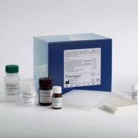 人淋巴细胞因子检测试剂盒