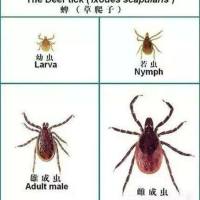 森林脑炎TBE-IgG抗体检测试剂（胶体金法）