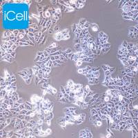 MHCC-97L | 人低转移性肝癌细胞 | MHCC-97L细胞 | MHCC97L