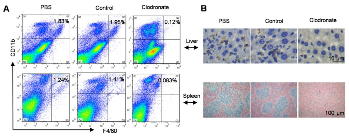 巨噬细胞清除小课堂 | 第二课：肝脏