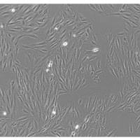 心肌细胞缺氧模型构建