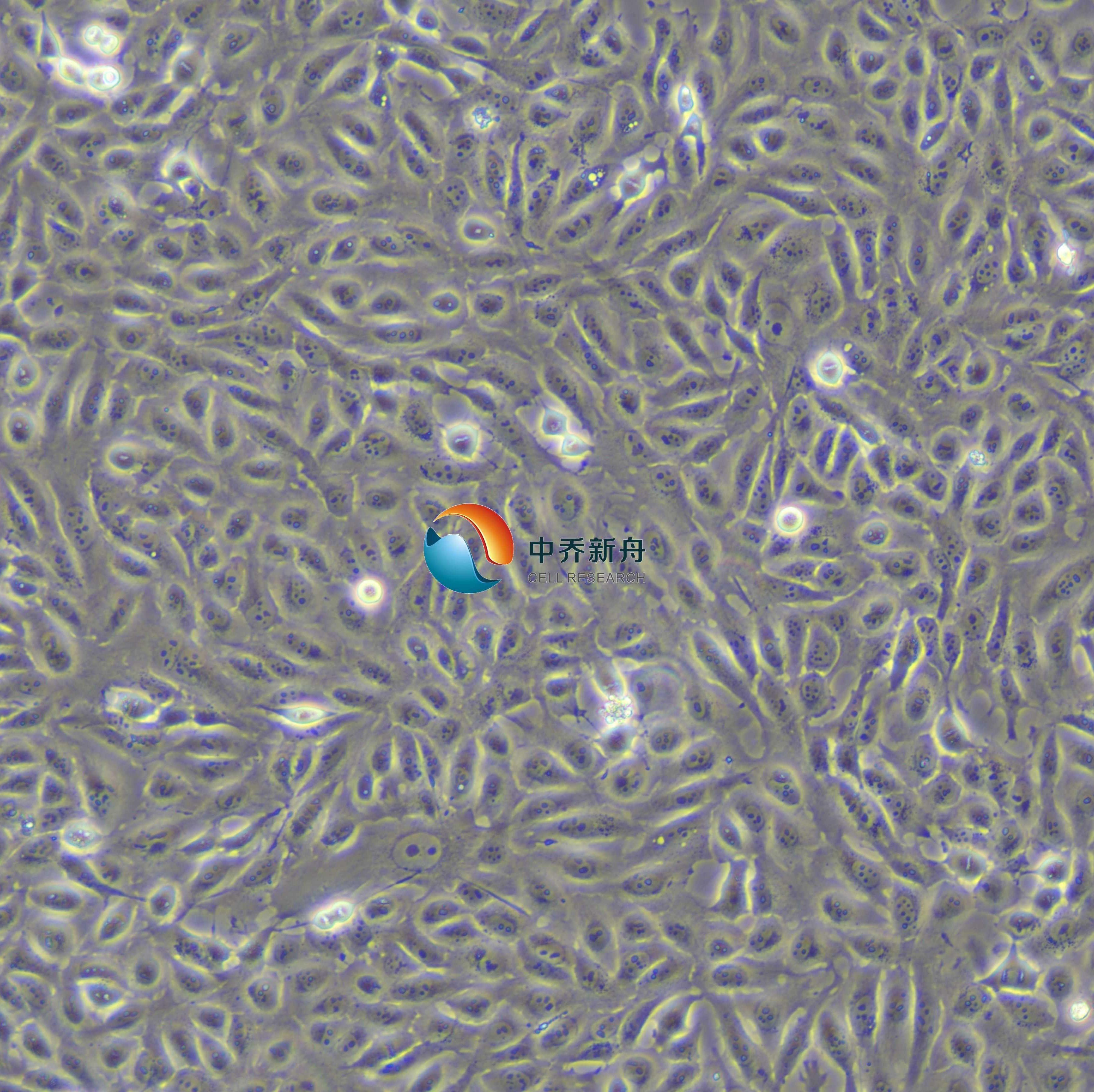 GES-1人胃粘膜上皮细胞(STR鉴定)