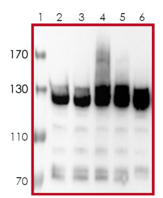 泛素酶：泛素化研究的基石，PROTAC开发的核心