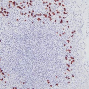 徕卡病理-免疫组化抗体-CISH 探针，BOND Lambda 探针