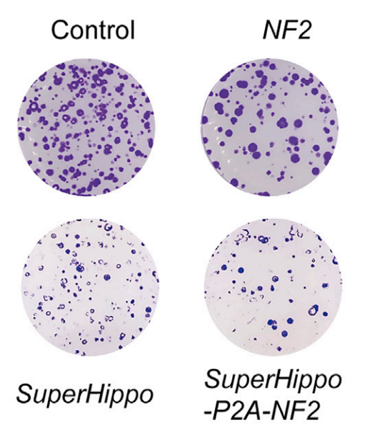 细胞功能性实验篇4-克隆形成实验