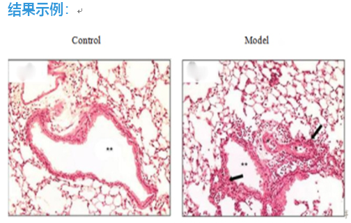 屋尘螨 Mites,House Dust(D.pterony