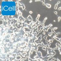 SH-SY5Y 人神经母细胞瘤细胞|SH-SY5Y|SH-SY5Y细胞|SHSY5Y|SHSY5Y