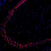 免疫荧光单标（双色）