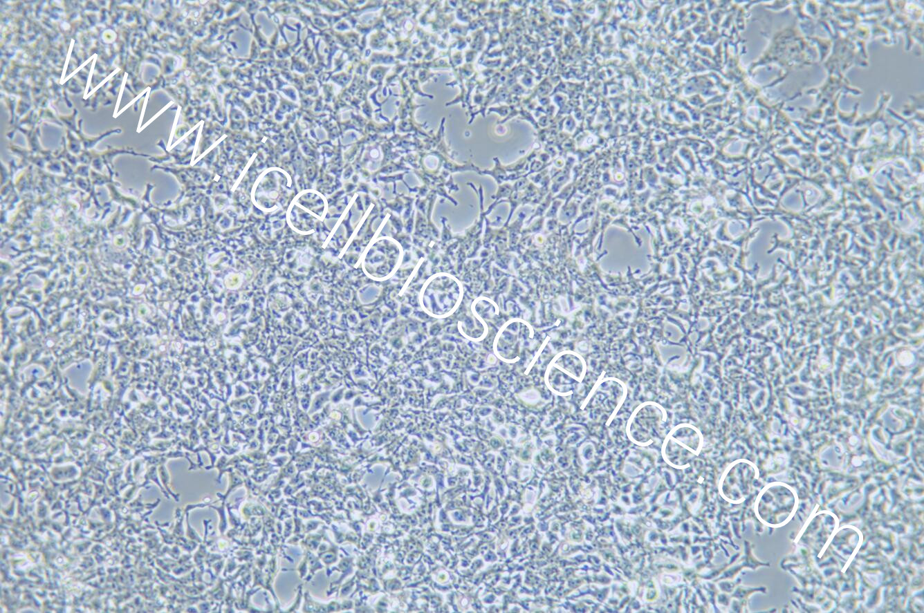 AAV-293 |AAV-293细胞|AAV293|AAV2