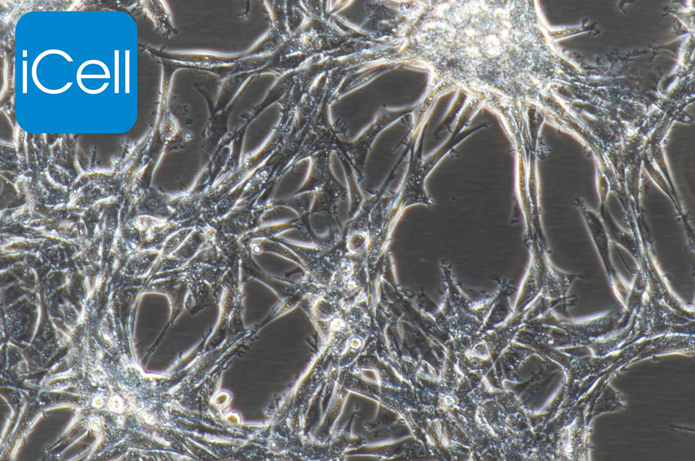 U87 MG 人脑星形胶质母细胞癌细胞|U87MG|U87M