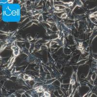 A172细胞 | A-172细胞 | A-172 | A172 | A172 人脑胶质瘤细胞/STR鉴定/镜像绮点