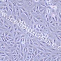 AN3CA |AN3CA细胞|AN3-CA|AN3-CA细胞|AN3-CA人子宫内膜腺癌细胞/STR鉴定