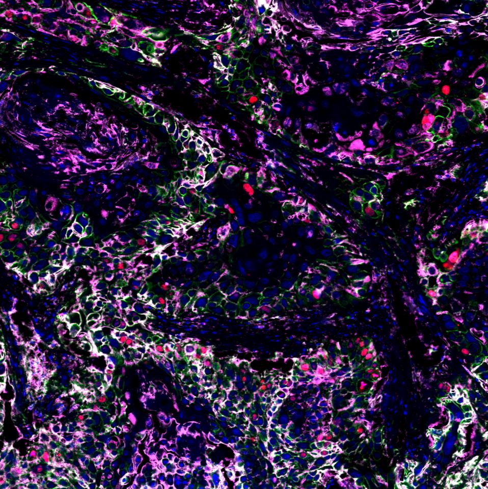 免疫荧光四标（五色）