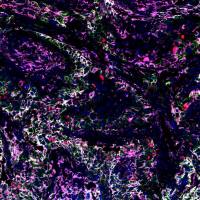 免疫荧光四标（五色）