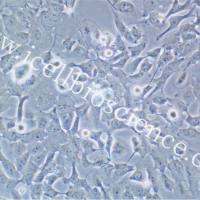 SK-GT-4 |SK-GT-4细胞 |SKGT4 |SKGT4细胞 |SK-GT-4 人食道癌肿瘤细胞/STR鉴定/镜像绮点（Cellverse）