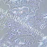 NCI-H2170 |NCI-H2170细胞|NCIH2170|NCIH2170细胞|人肺癌细胞/STR鉴定/镜像绮点(Cellverse)