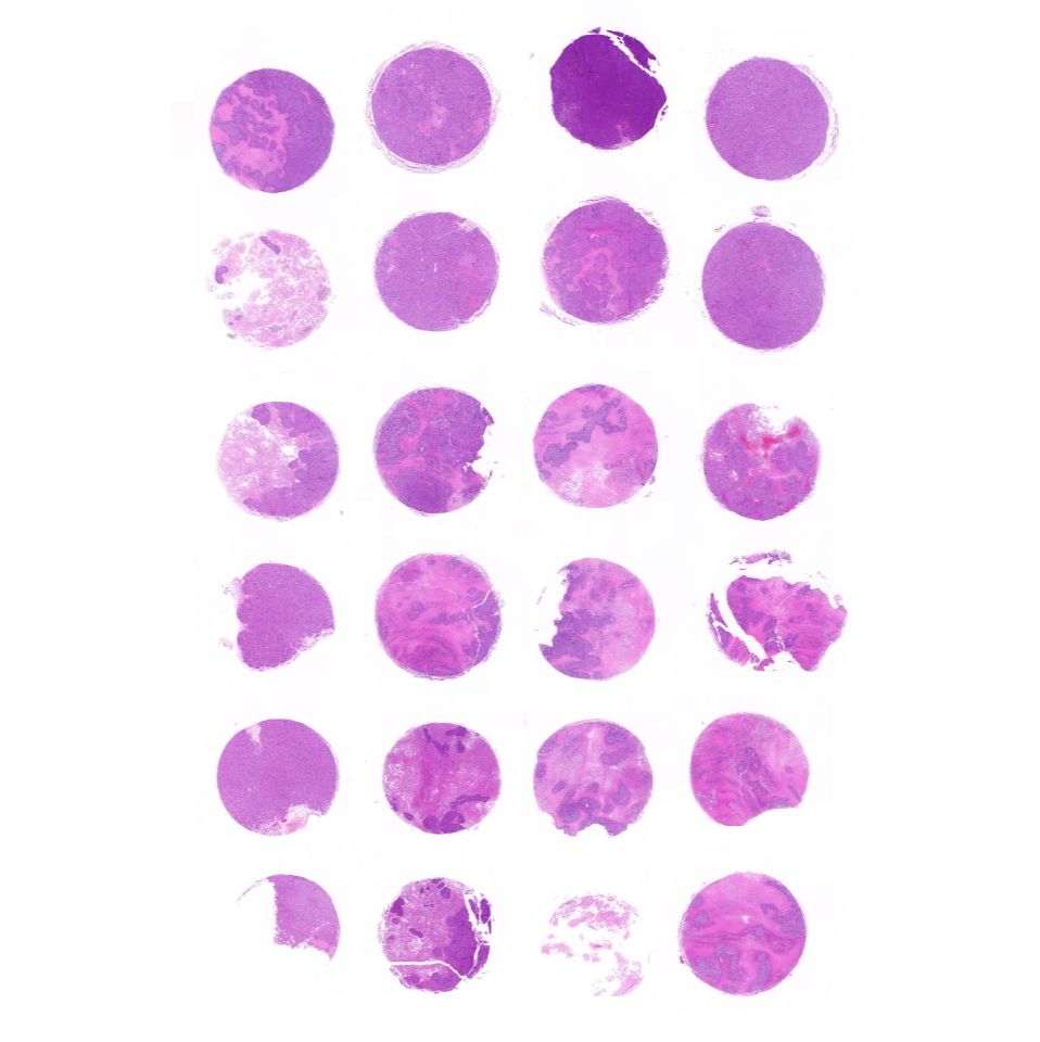 组织芯片扫描(明场)