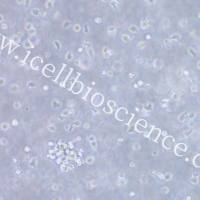 MEC-1 |MEC-1细胞|MEC1|MEC1细胞|MEC-1人慢性B细胞白血病细胞/STR鉴定/镜像绮点（Cellverse）