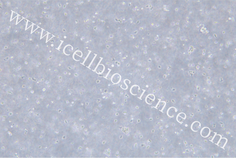 MEC-1 |MEC-1细胞|MEC1|MEC1细胞|MEC