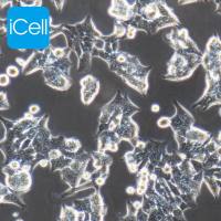 HCT116 人结肠癌细胞|HCT116细胞|HCT-116|HCT-116细胞|HCT116/STR鉴定/镜像绮点（Cellverse）