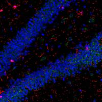 组织芯片扫描(荧光单标)