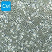 NCI-H1915细胞 | NCI-H1915细胞 | NCI-H1915 | 人非小细胞