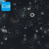 A431 |A431细胞|A-431|A-431细胞|A-431人表皮癌细胞/STR鉴定/镜像绮点(Cellverse)