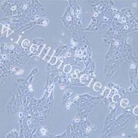 WSU-HN30 |WSU-HN30细胞|WSUHN30|WSUHN30细胞|WSUHN30人口腔鳞状癌细胞/STR鉴定/镜像绮点(Cellverse)