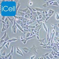 Renca |Renca细胞|Renca细胞|小鼠肾癌细胞/种属鉴定/镜像绮点（Cellverse）