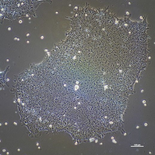 基于人诱导多能干细胞技术(iPSC)的疾病机制研究解决方案