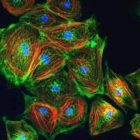 Axol Bioscience axoCells心室心肌细胞