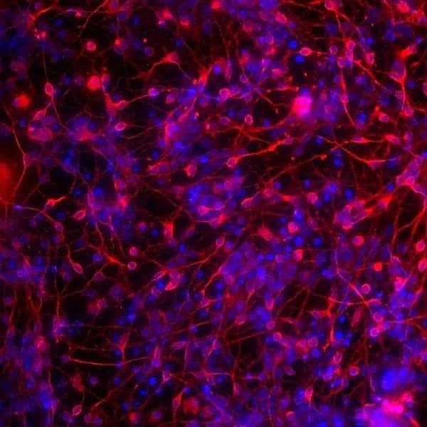 Axol Bioscience axoCells皮层抑制性中间神经元