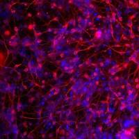 Axol Bioscience axoCells皮层抑制性中间神经元