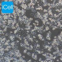 MB49 |MB49细胞|MB-49|MB-49细胞|MB-49小鼠膀胱癌细胞/种属鉴定