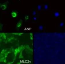 Axol Bioscience axoCells心房心肌细胞