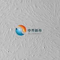 人滑膜成纤维细胞