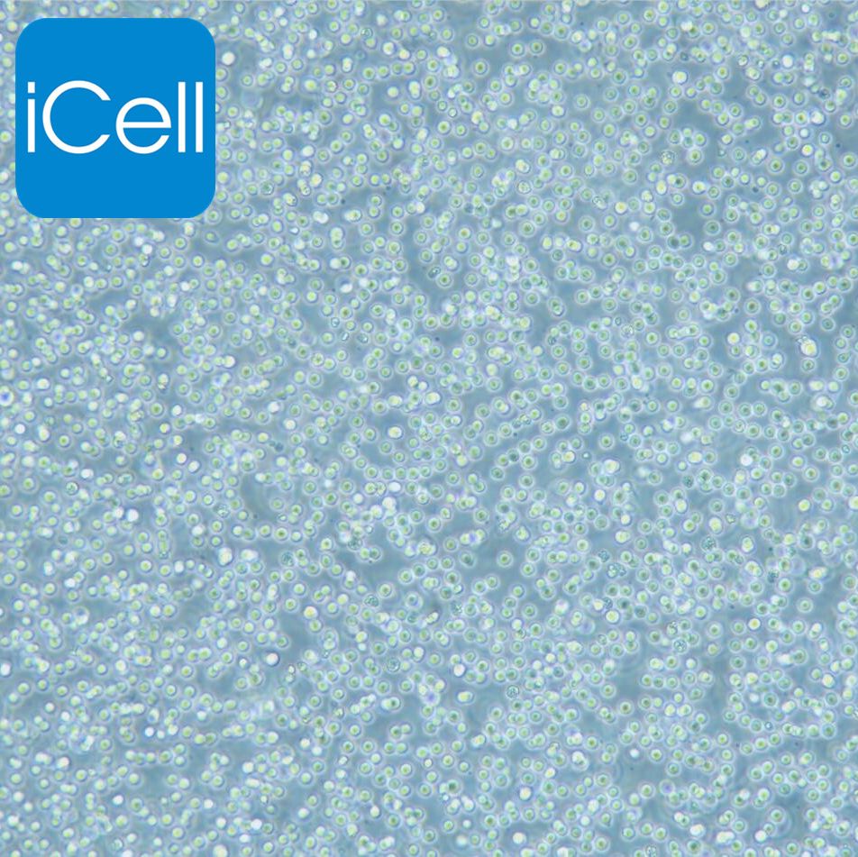 SU-DHL-4 |SU-DHL-4细胞|SUDHL4|SUDHL4细胞|SUDHL4人B淋巴瘤细胞/STR鉴定/镜像绮点(Cellverse)