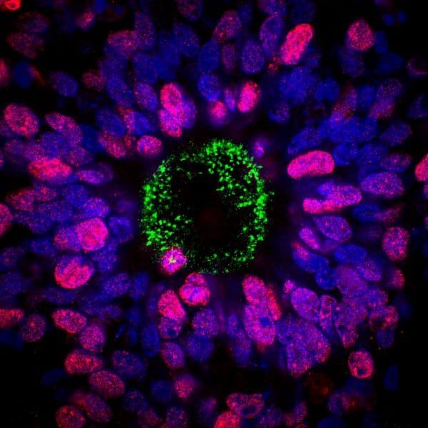Axol Bioscience axoCells皮层兴奋性/谷氨酸能神经元-ax5111