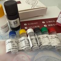 Human Metapneumo Virus(hMPV)人偏肺病毒探针法荧光定量RT-PCR试剂盒