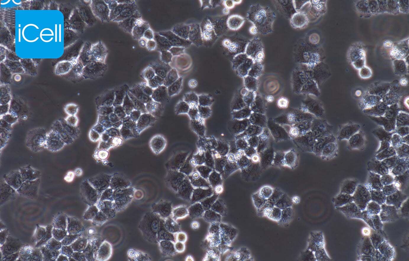 Caov3 | Caov3细胞 | Caov-3 | Cao