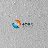 人椎间盘终板软骨细胞