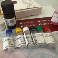 Plasmodium falciparum镰刀疟原虫(恶性疟原虫)探针法荧光定量PCR试剂盒